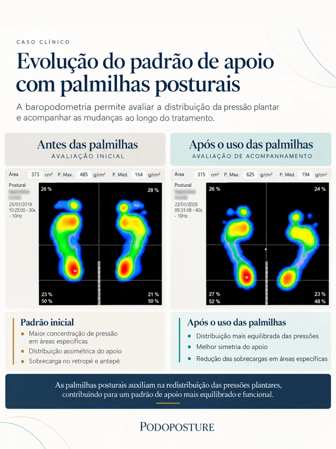 Tela de notebook com o mapa colorido da pressão dos dois pés, em duas medições lado a lado, com a porcentagem de carga de cada região.